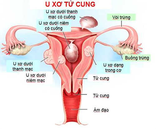 các bệnh phụ khoa nguy hiểm 2 các bệnh phụ khoa nguy hiểm 2