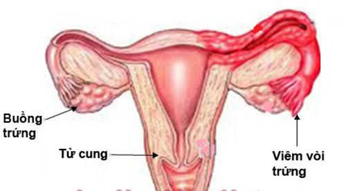 các bệnh phụ khoa nguy hiểm 5 các bệnh phụ khoa nguy hiểm 5
