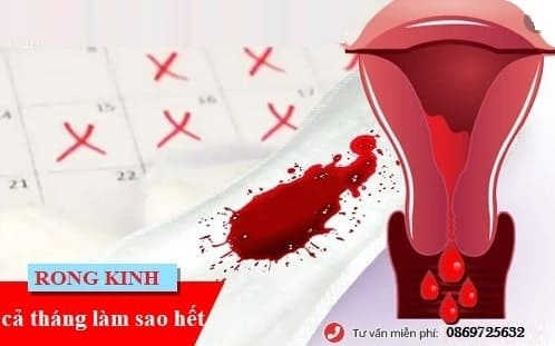 Phải làm sao khi bị rong kinh kéo dài