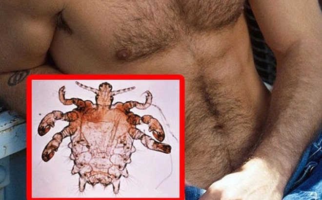 dấu hiệu viêm bao quy đầu