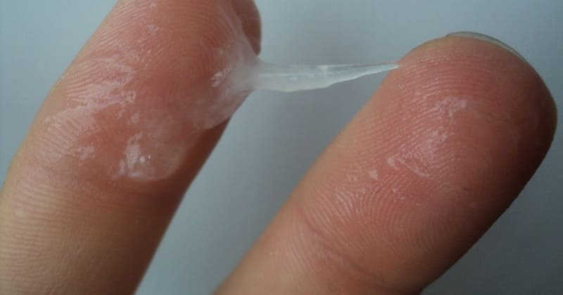 khí hư ra nhiều có mùi hôi