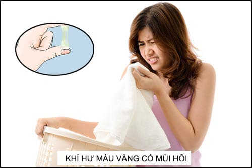 ra nhiều khí hư có mùi hôi là bệnh gì