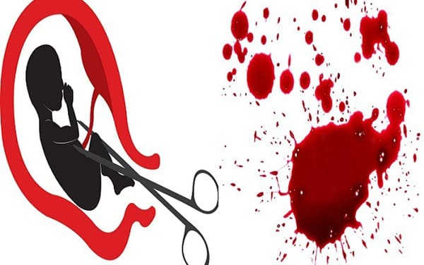 Rong kinh sau phá thai