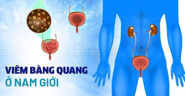Tiểu buốt ra dịch mủ là bệnh gì