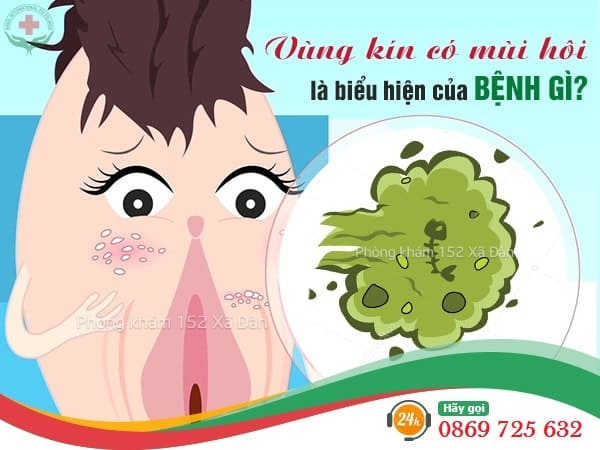 Vùng kín có mùi hôi cảnh báo là bệnh gì?