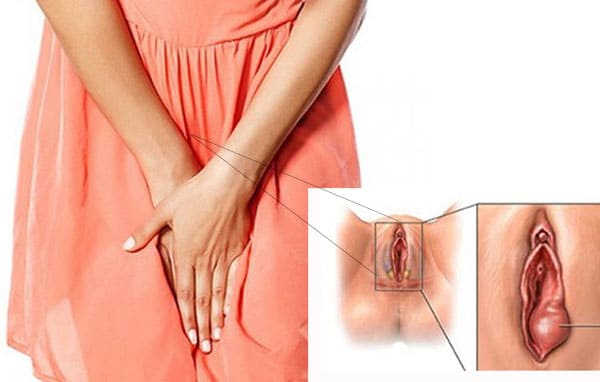 Âm đạo sau sinh sẽ trông như thế nào