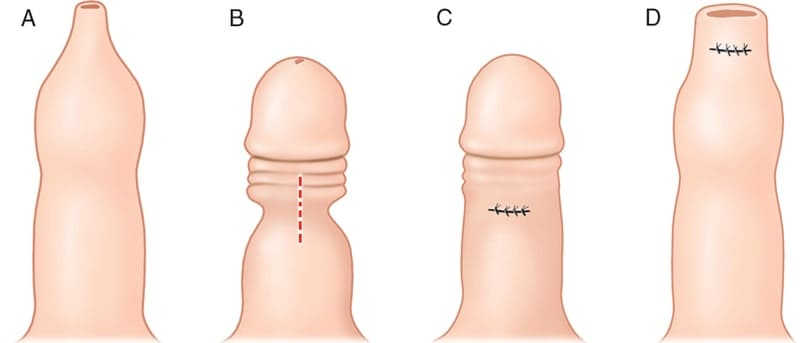 chức năng của bao quy đầu