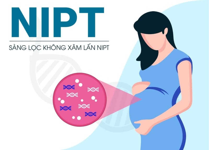 xét nghiệm nipt sàng lọc trước sinh