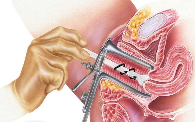 khám sức khỏe sinh sản tiền hôn nhân
