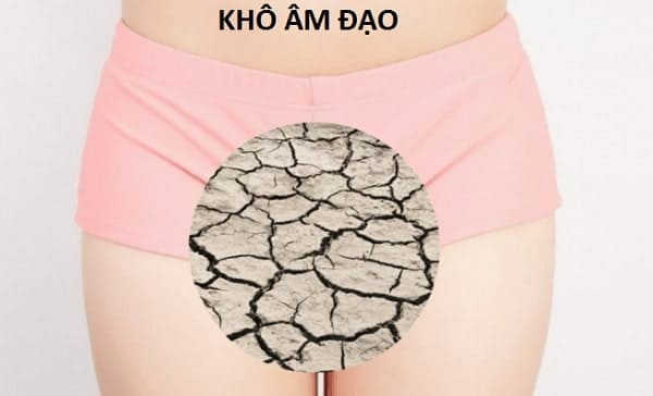 khô âm đạo là gì
