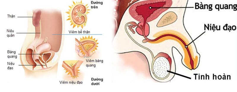viêm niệu đạo là gì
