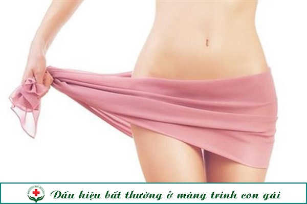 bat-thuog-o-mang-trinh