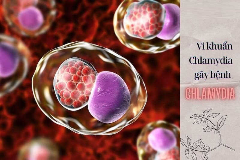 bệnh chlamydia là gì