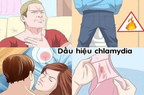 Dấu hiệu bệnh chlamydia