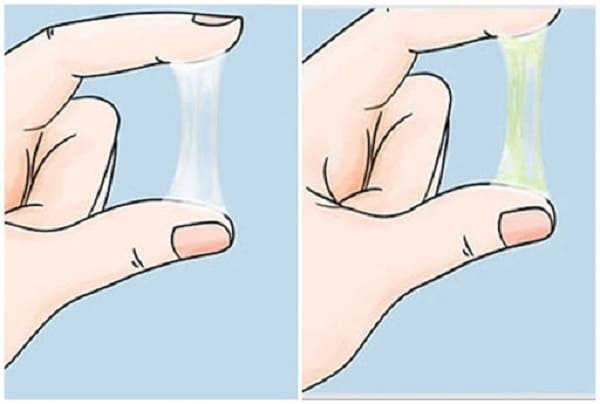 ra khi hư màu xanh là bệnh gì