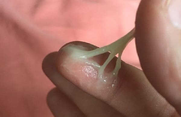 khí hư màu xanh có nguy hiểm không