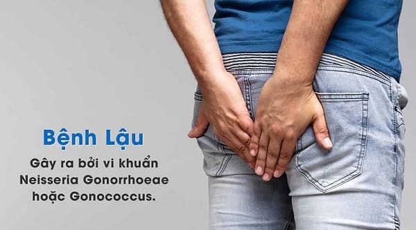 chữa bệnh lậu bao lâu thì khỏi