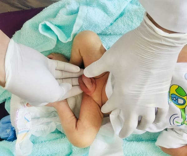 tinh hoàn ẩn là gì