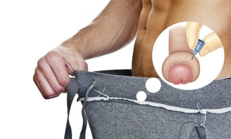 Sưng to bao quy đầu sau khi cắt có sao không