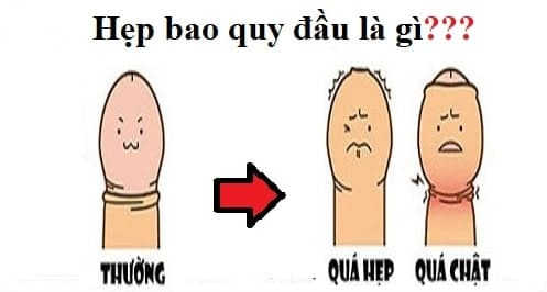 Các bệnh bao quy đầu thường gặp
