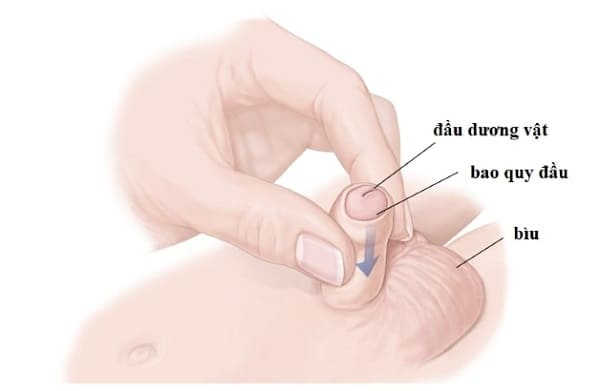 hướng dẫn cách rửa bao quy đầu ở trẻ em