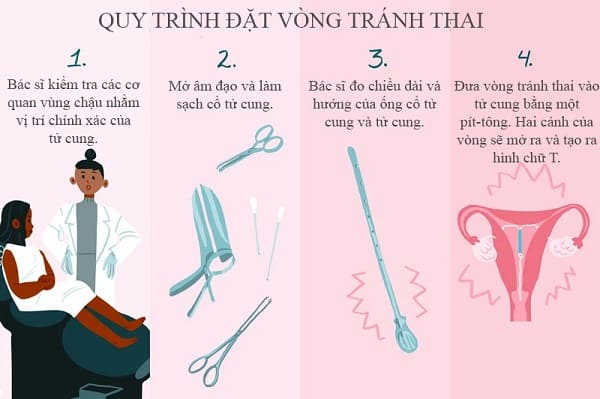 sau đặt vòng bao lâu thì quan hệ được với chồng như bình thường
