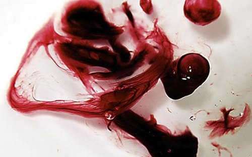 uống thuốc phá thai ra máu