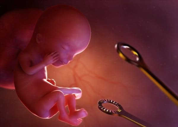 cách phá thai tháng đầu tiên