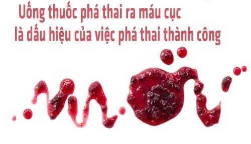 hướng dẫn sử dụng thuốc phá thai đúng cách