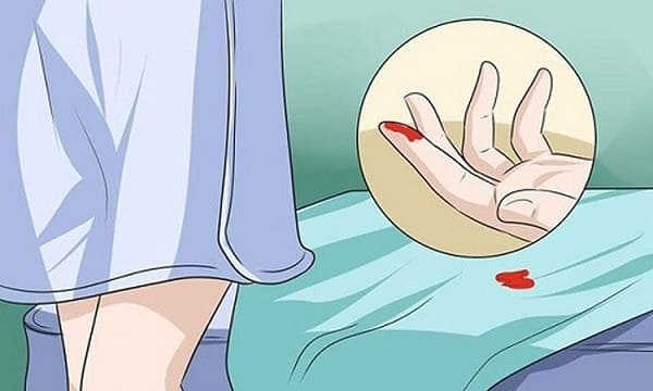 làm sao để hết ra máu sau khi phá thai 3