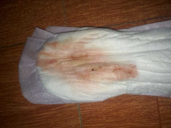 hình ảnh máu báo thai