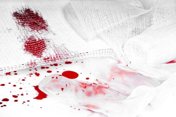 phá thai bằng thuốc sau 3 tuần vẫn ra máu