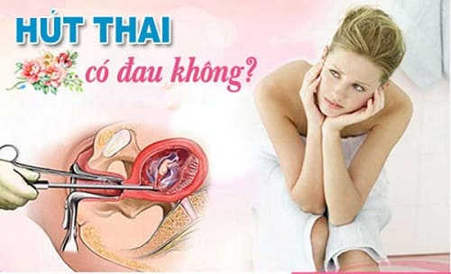 phá thai có đau không