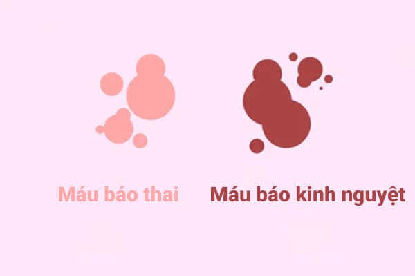 phân biệt máu báo thai và kinh nghuyệt