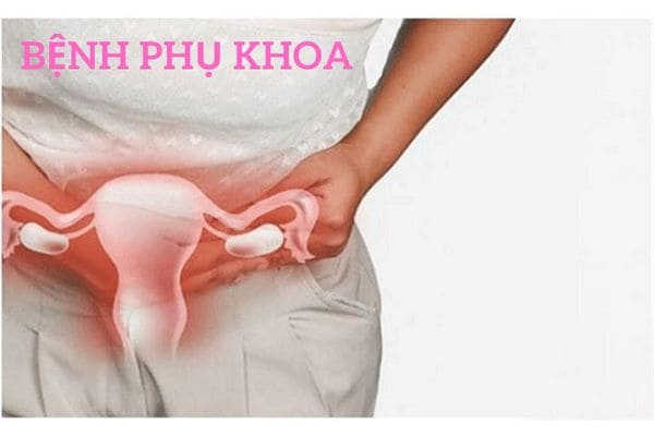 bệnh phụ khoa là gì