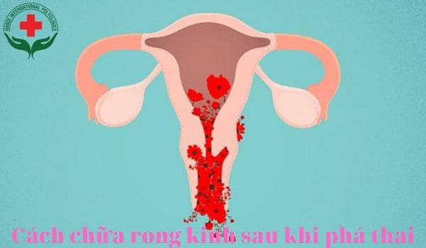 cách chữa rong kinh sau khi phá thai