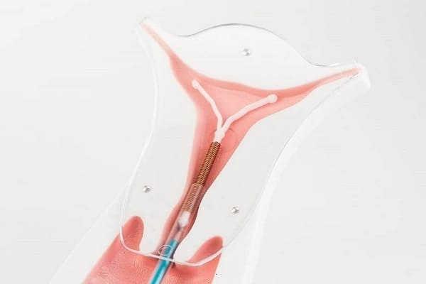 Đặt vòng tránh thai bao lâu thì quan hệ được 2