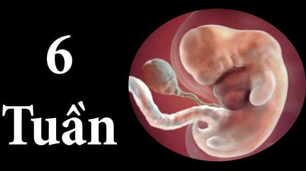 thai 6 tuần tuổi phá bằng cách nào
