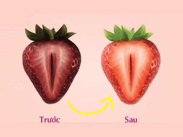 cách xõa thâm vùng kín đẹp xinh