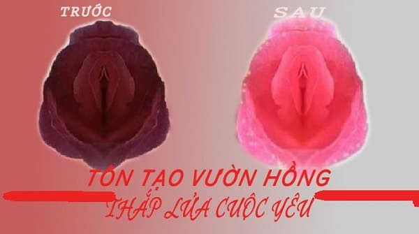 xóa thâm làm đẹp vùng kín