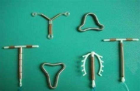 đặt vòng tránh thai kiêng bao lâu thì quan hệ