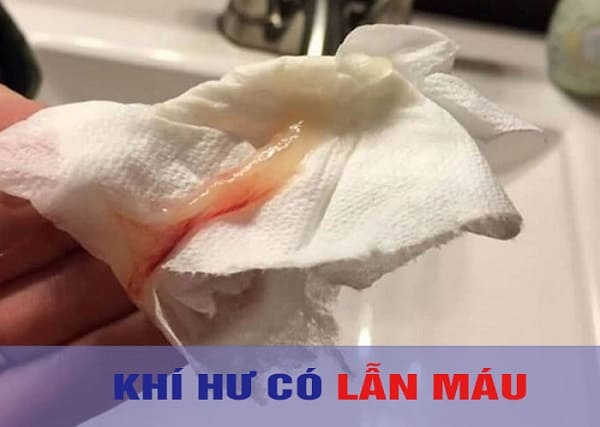 khi hư ở tuổi dậy thì lẫn máu