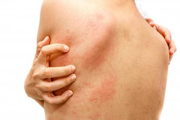 uống thuốc kháng sinh có làm chậm kinh không?