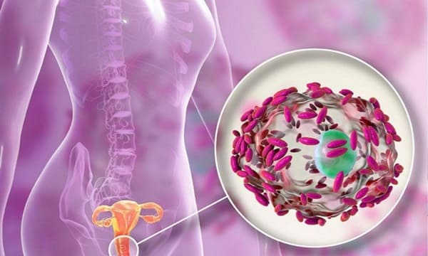 viêm âm đạo do tạp khuẩn là gì 2