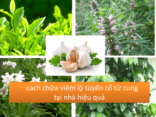 cách chữa viêm lộ tuyến tại nhà