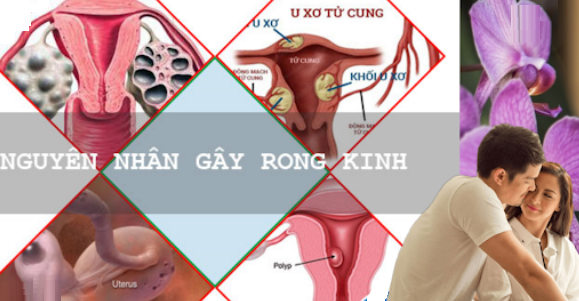 Lý do vì sao bị rong kinh cả tháng không giảm