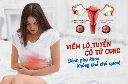 viem-lo-tuyen-cap-do-3